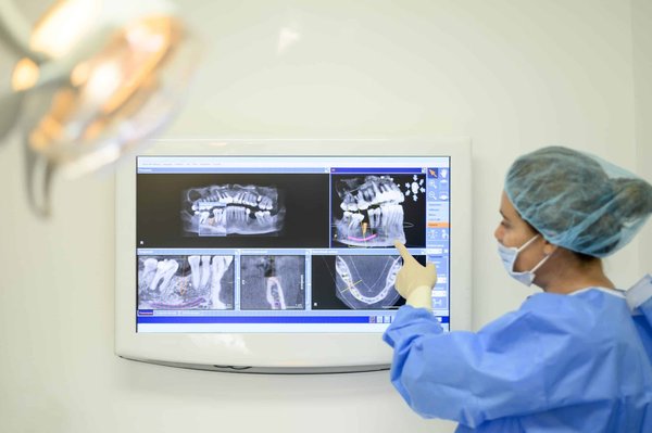 Où et comment implanter un trampoline dans votre jardin ?